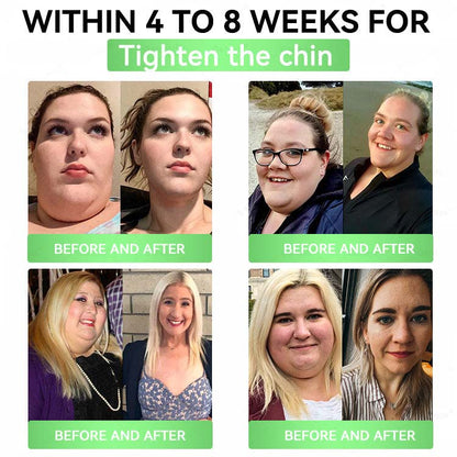 ✔Alcuras™ Moringa × Berberine × AMPK 8-Benefit Metabolic Support Nano Microneedle Patch 🇺🇸 Just once a day · Designed to support visible body changes in as little as 7 days ✅ For stubborn weight, loose-looking skin, blood sugar balance, sleep quality