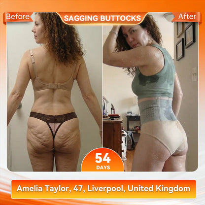 🎖️𝐎𝐟𝐟𝐢𝐜𝐢𝐚𝐥 𝐁𝐫𝐚𝐧𝐝 𝐒𝐭𝐨𝐫𝐞 |Mresio® 🐎✨𝟐𝟎𝟐𝟔Moringa & Berberine 4-in-1 Body Sculpting Shorts – Tummy, Hips & Thigh Contouring